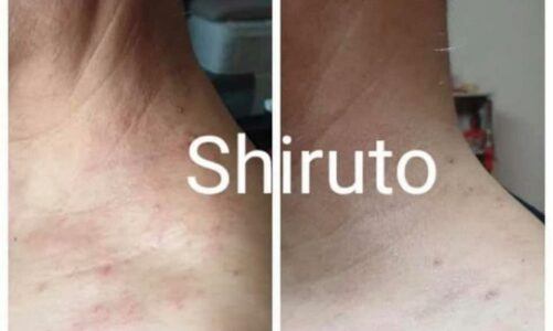 Shiruto – 皮膚敏感