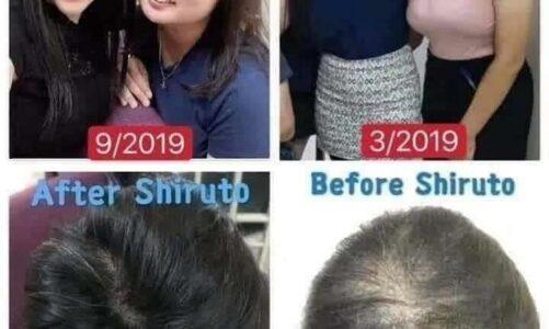 Shiruto – 改善脫髮問題
