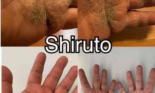 Shiruto & Aulora – 皮膚過敏
